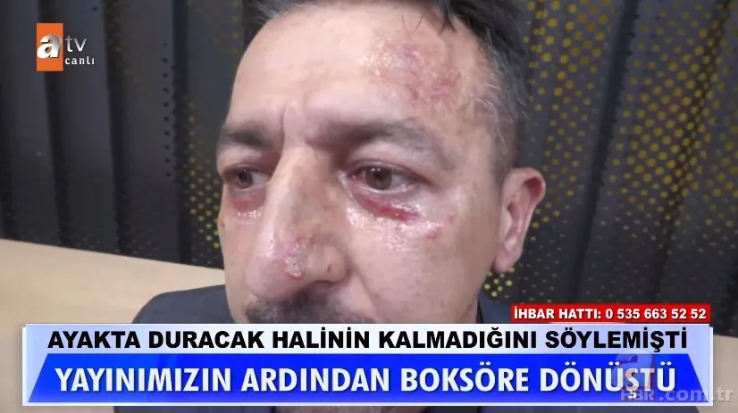 Müge Anlı'daki üfürükçü boksör çıktı! Başka bir konuğa saldırdı 9