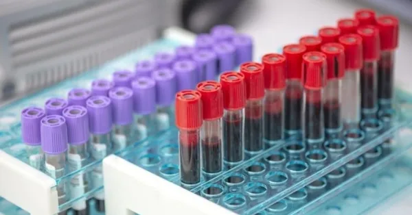 Hangi kan grubu daha sağlıklı? Hava kirliliğine karşı en dirençli kan grubu hangisi? İngiltere’deki flaş araştırma sonuçlandı