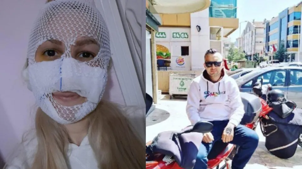 Eski sevgili vahşeti! Yüzüne kimyasal atılan Sultan: Onun ev hapsi bitti, benimki başladı
