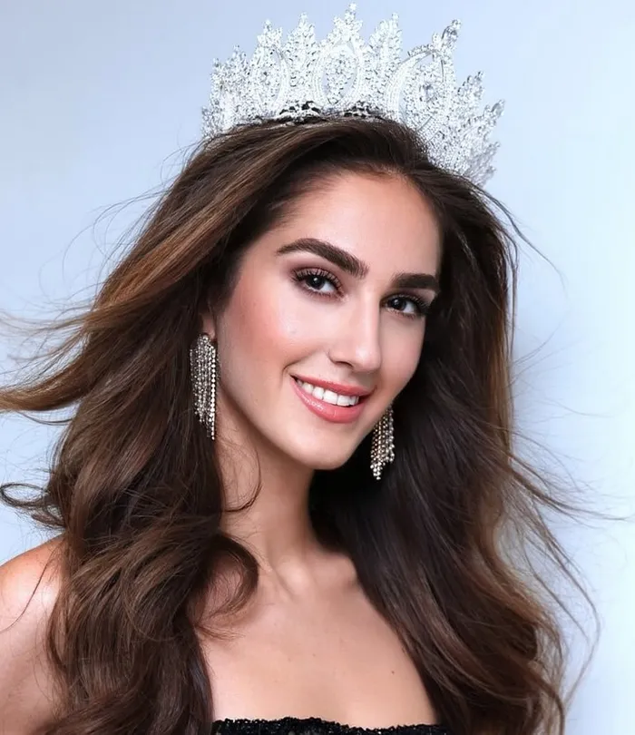 miss-turkey-2024-birincisi-idil-bilgen-ulkemizi-temsil-edecek-1745042693375.jpg Kaynak: Instagram