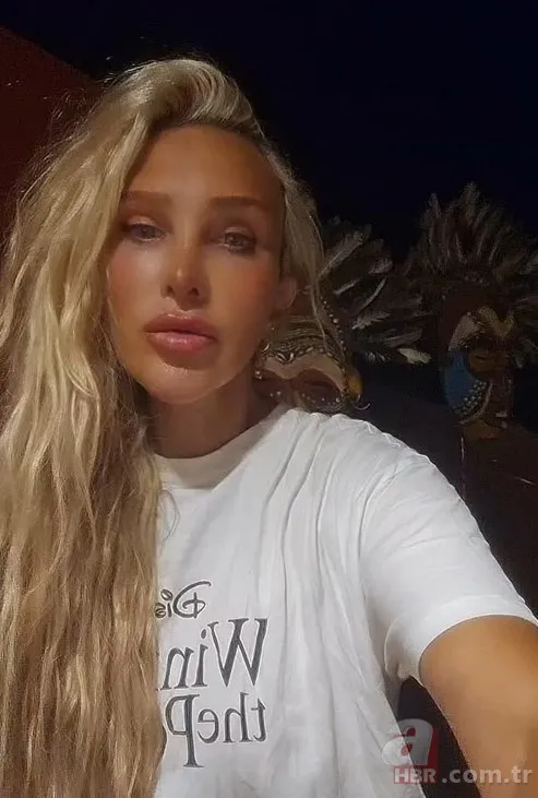 Sağlık Bakanlığı'ndan yardım istedi! Seren Serengil'in annesi yoğun bakımda 3