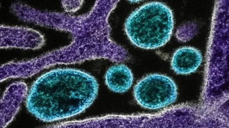 Nipah virüsü nedir, tehlikeli mi, Türkiye’de var mı? Hindistan’da görülen Nipah virüsü belirtileri neler, nasıl bulaşır?