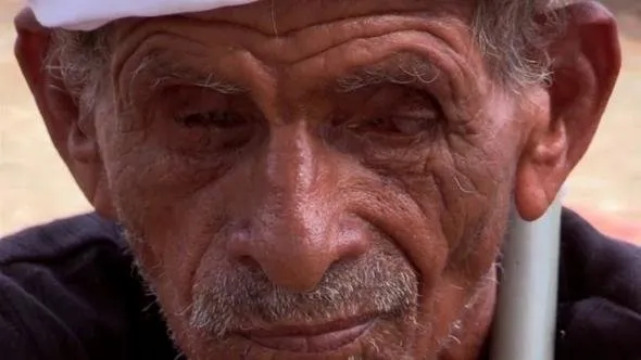 Genetik bozukluk Yemen’de bir köyü kör etti
