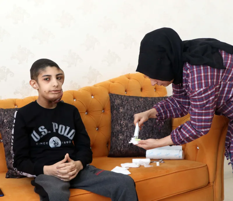 Çenesinin altına kadar indi! Yüzündeki yara her geçen gün büyüyor