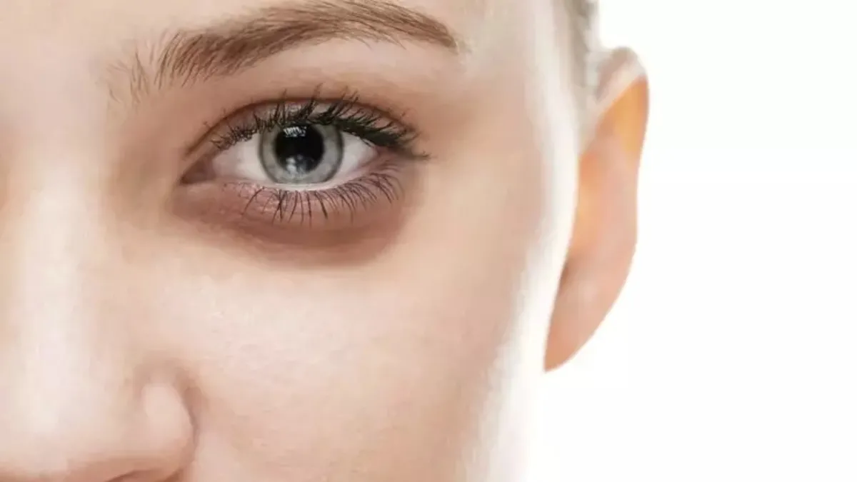 Gözaltı morlukları dert olmaktan çıkacak! 1 ay boyunca...