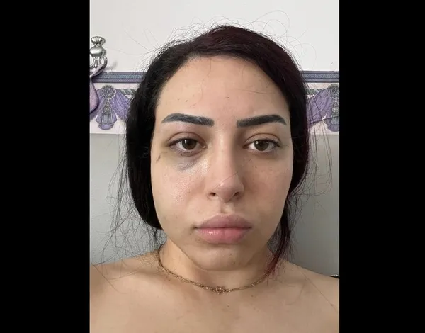 1686042462092.jpg Dişlerini kırıp duvardan itmişlerdi! İlk kez A Habere’e konuştu | Türk kıza ırkçı saldırıda yeni gelişme - 2
