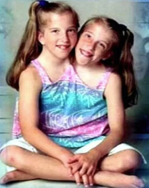abdde-mucize-gibi-olay-yasamaz-dedikleri-yapisik-ikizlerin-bebek-bekledigi-iddia-edildi-1735651253086.jpg Abby ve Brittany'nin çocukluklarına ait fotoğrafları (DailyMail aracılığıyla)