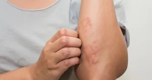 Egzama nasıl geçer?