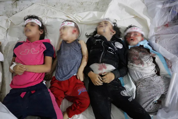 1698824084225.jpg Gazze'de insanlık suçu! Katili İsrail bir yaşını doldurmamış 133 bebeği öldürdü! Filistinli kadınların çaresizliği: Fener ışığında anestezisiz sezaryan doğum - 8