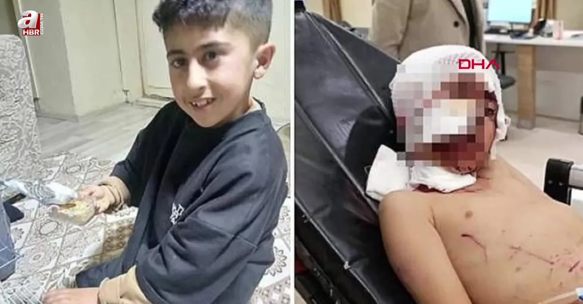 Erzurum'da sokak köpeği dehşeti!