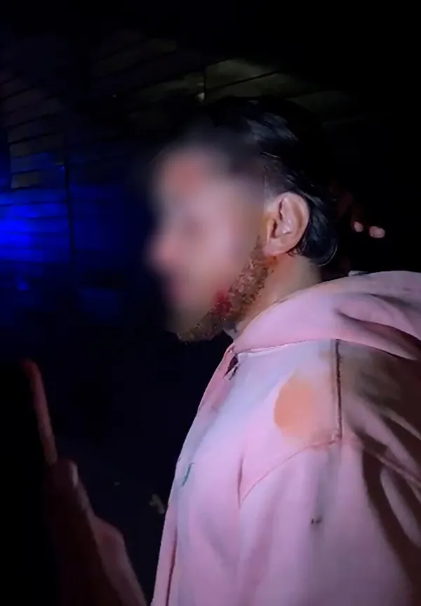 Bir alçak saldırı da Brüksel’de: PKK yanlıları oy kullanma alanından ayrılan genci yaraladı