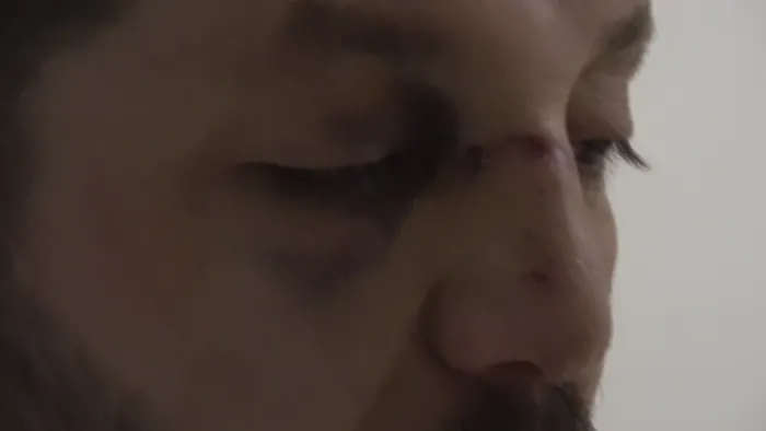 komsu-teroru-gurultu-tartismasinda-bebegin-kafatasi-catladi-1771786641462.jpg Fotoğraf-İHA