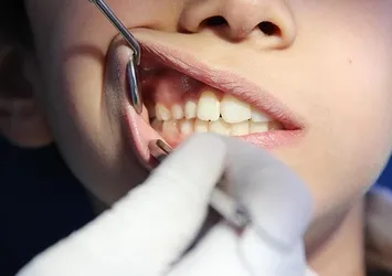 Uzmanından diş gıcırdatma ve çene sıkma uyarısı!