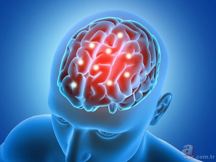 Brain rot nedir, ne demek? Yılın kelimesi seçilen Brain rot (Beyin Çürümesi) ne anlama geliyor? 2