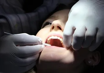 İlerleyen diş çürükleri tehlike saçıyor!