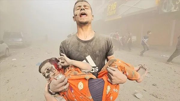 Gazze’de soykırım var! Filistin Sağlık Bakanı: Şifa Hastanesinde defnedilmeyi bekleyen cesetler çürümeye başladı