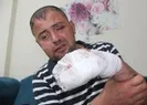 Rezalet! Gaziyi bu hale getirdiler