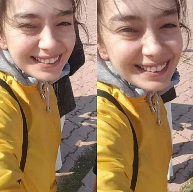 Ramo Nun Sibel I Esra Bilgic In Makyajsiz Hali Soke Etti