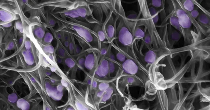 dso-uyardi-meksikada-ilk-olumcul-h5n2-kus-gribi-vakasi-1717621587395.jpg DSÖ uyardı: İnsanlar üzerinden ölümcül etkili virüs! Meksika'da ilk ölüm yaşandı | Dünya genelinde yayılma endişesi - 3