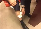 AK Parti milletvekili Muhammet Baltanın bacağını kim ısırdı?