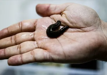 Sülük tedavisinin sağlık üzerindeki etkileri