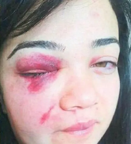 eski-esinden-siddet-goren-kadina-cocugundan-uyari-topuklu-giyme-babam-gorurse-kacamazsin-1576600487907.jpg Eski eşinden şiddet gören kadına çocuğundan uyarı: 'Topuklu giyme, babam görürse kaçamazsın' - 2