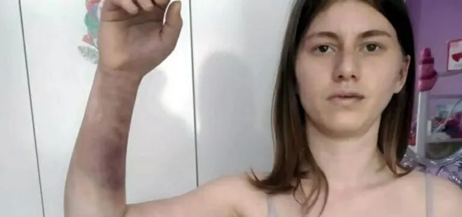 İzmir’de erkek arkadaş dehşeti! Önce beyzbol sopasıyla darbetti sonra şantaj yaptı