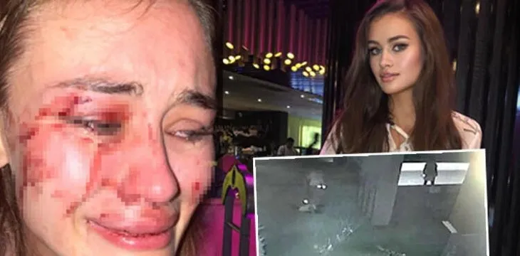 Daria Kyryliuk’u sevgilisi mi dövdü? Sürpriz tanıktan Ukraynalı model ile ilgili yeni iddia