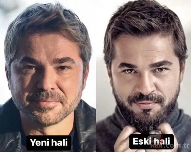 Binlerce lirası boşa gitti! Estetiği fazla kaçıran Meryem Uzerli tanınmaz hale geldi! 13