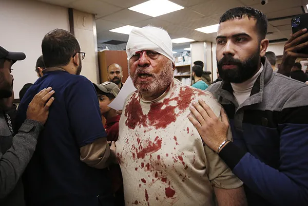 disisleri-bakanligindan-israile-tepki-katliama-son-vermek-zorundadir-1709317800705.jpg İsrail zulmü durmak bilmiyor! Son saldırıya Dışişleri'nden çok sert tepki: Er veya geç adalet önünde hesap vereceksiniz - 2