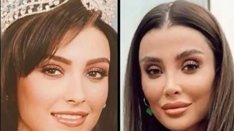 Özge Ulusoy fitlik sırrını verdi: "Tek bir şey var..."