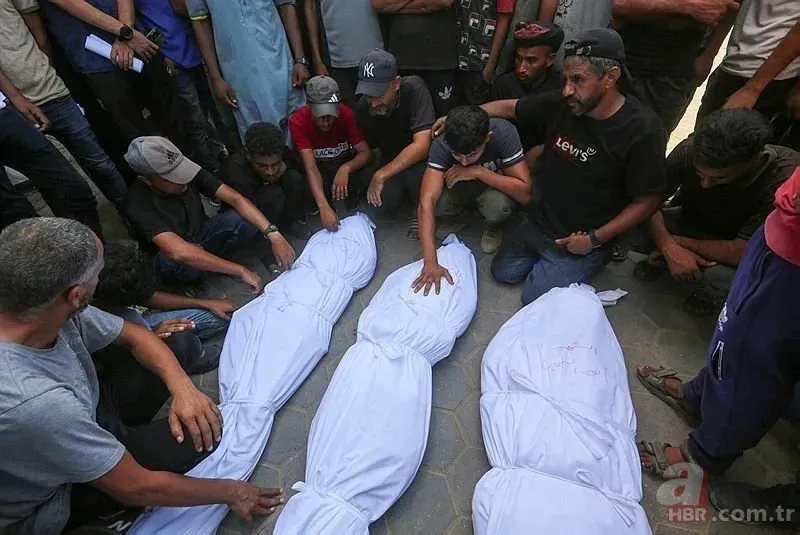 ABD'li doktor soykırımcı İsrail'in acımasızlığını herkese duyurdu: Karnından ve göğsünden vurulmuş çocuklar gördüm 10