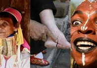 O ülkelerde güzelliğin bedeli ağır: İşte tarihe geçen sıra dışı uygulamalar