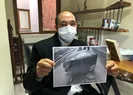 Patolojiye gönderilen organı kayboldu
