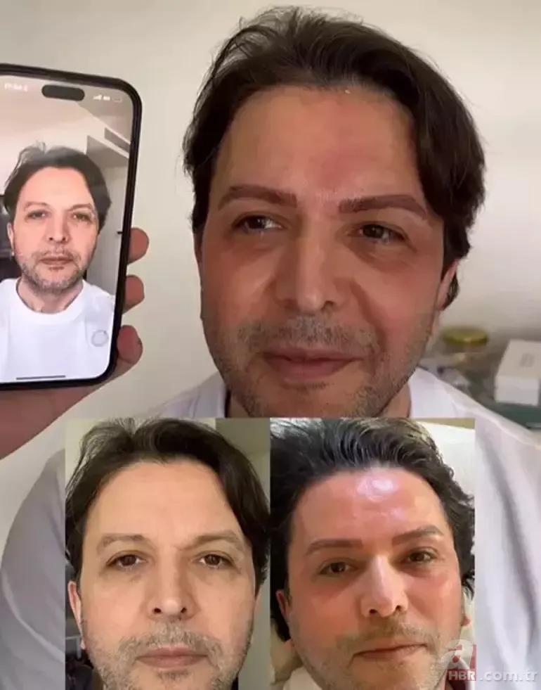 Estetik yaptıran Nihat Doğan'ı görenler şoke oldu! Son hali dillere düştü 7