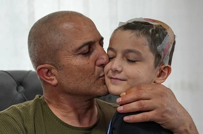 Köpeklerin saldırısında yaralanan Tunahan’ın babasından muhalefet vekillerine sert tepki! CHP’li vekil ’sen kimsin’ diyerek kovmuştu | Acılı baba o anları anlattı