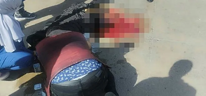 Afyonkarahisar’da feci kaza! Hamile kadının bacağı koptu
