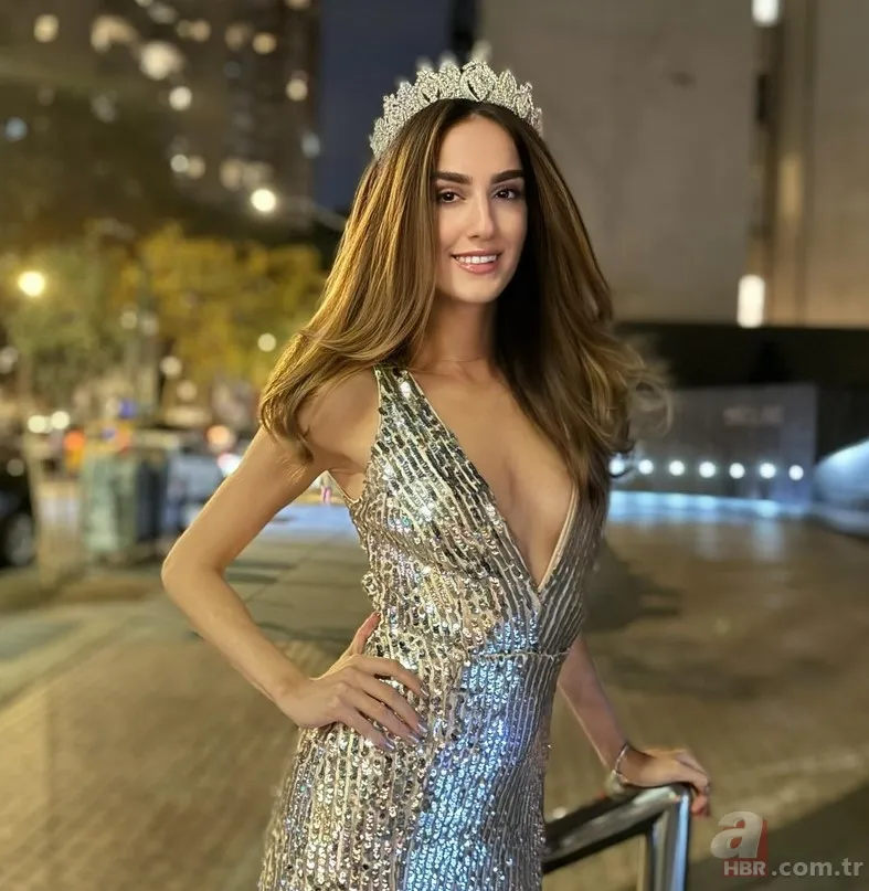 Büyük değişim! Miss Turkey 1. İdil Bilgen'in son hali şaşırttı 5