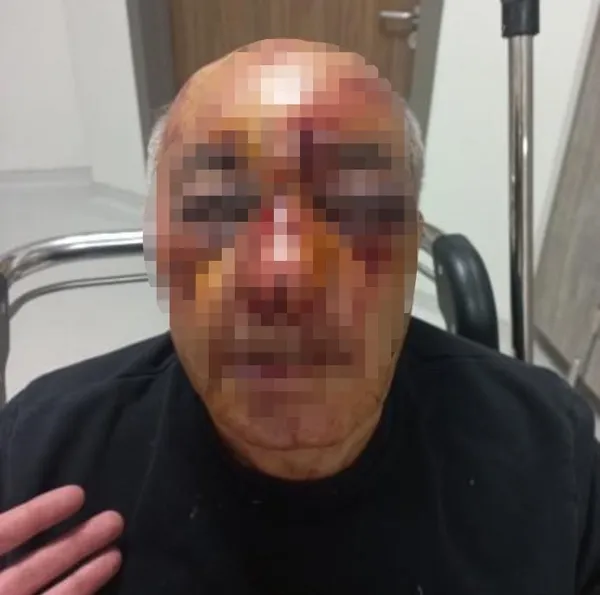 1701350943557.jpg Ankara'da kan donduran olay: Taksi şoförünü öldüresiye dövdü - 1