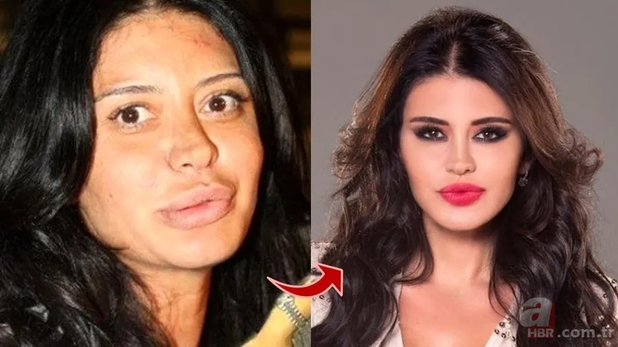 Bir Zamanlar Çukurova’nın Betül’ü İlayda Çevik ortaya çıkan fotoğrafıyla şoke etti! 11