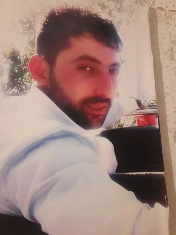 av-tufegi-temizlerken-yuzunun-yarisini-kaybetti-tek-hayali-normal-insanlar-gibi-olmak-1630486517033.jpg Av tüfeği temizlerken yüzünün yarısını kaybetti, tek hayali normal insanlar gibi olmak - 4