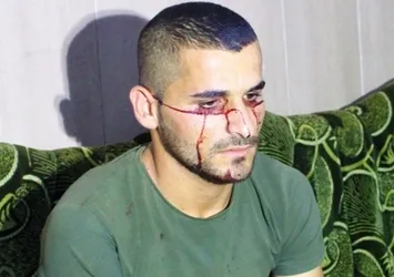 Görenler inanamıyor! Resmen kan ağlıyor...