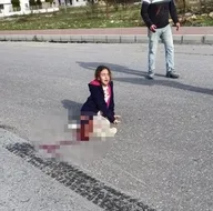 Bacağı paramparça oldu