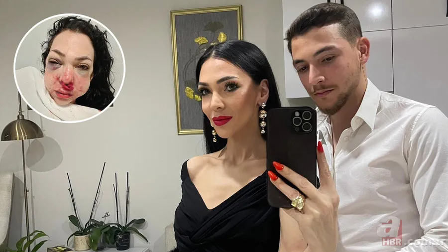 “Küfür etmeyin” dedi, dehşeti yaşadı: Genç kadın oğlunun gözü önünde öldüresiye dövüldü 1