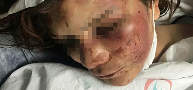 Şanlıurfa’da birlikte yaşadığı kadına işkence eden sanığa 34 yıla kadar hapis istemi