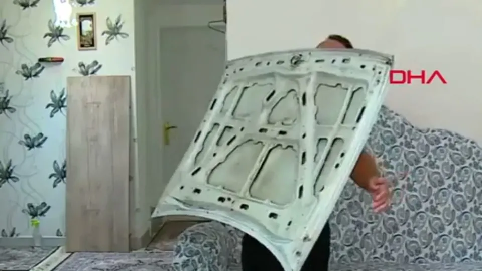 Görenler hayrete düşüyor! Ağrıları dahil her şeyi çekiyor