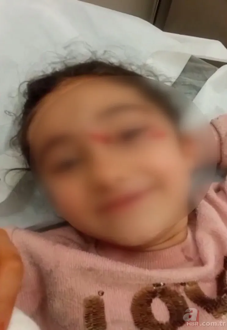 Başıboş köpekler dehşet saçtı! 6 yaşındaki Şirin'e saldırdılar 4