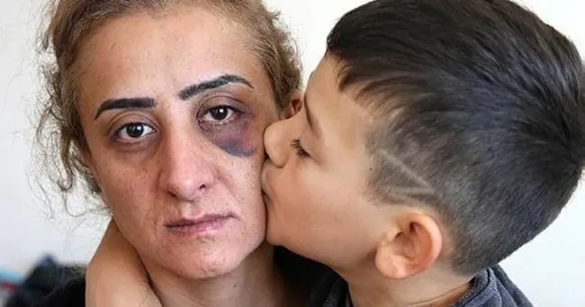 antalyada-yasayan-dilek-goktasin-yardim-cigligi-hayatim-kabus-oldu-olmek-istemiyorum-1623130739511.jpeg Antalya’da yaşayan Dilek Göktaş’ın yardım çığlığı: Hayatım kâbus oldu ölmek istemiyorum - 1