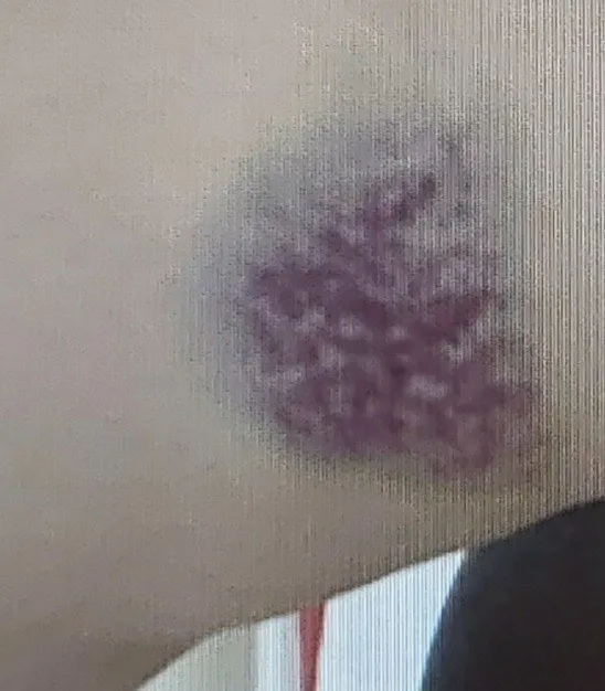 Son dakika: Maganda İETT şoföründen trajikomik savunma: Otobüste doğum günü yaptılar! Yolcular yaralanmıştı - 6