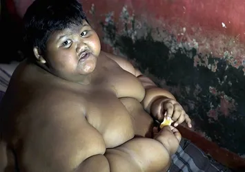 10 yaşında 190 kilo!